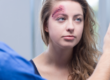 concussion, urgent care